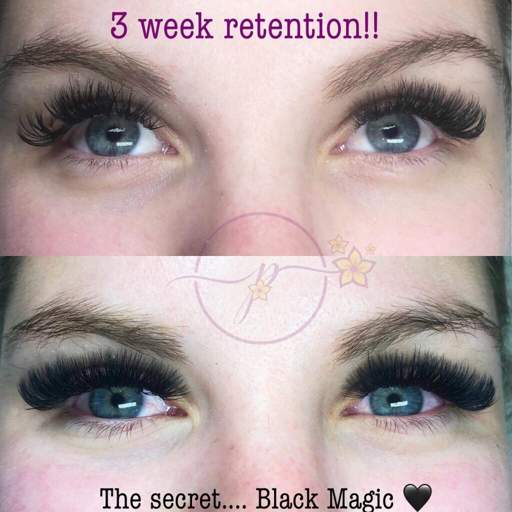 Cyanoacrylate The ins and outs ⋆ Plumerian